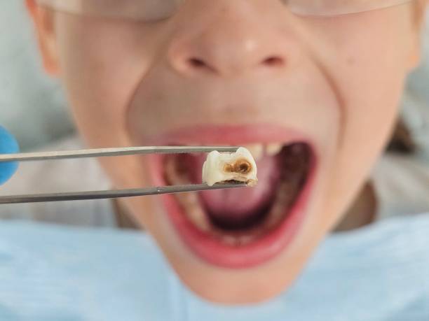 Best Mobile Emergency Dentist in Vernon, AL