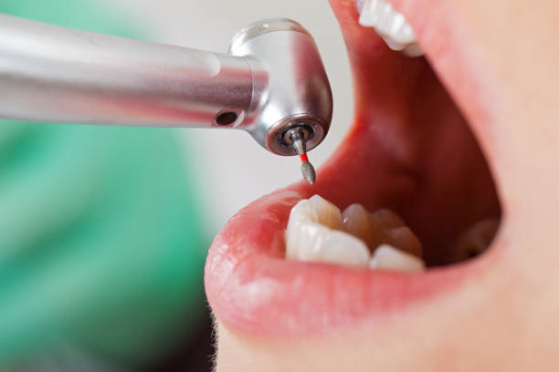 Best Pediatric Emergency Dentist in Vernon, AL